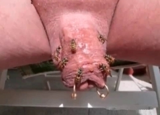 Dick stung by bees